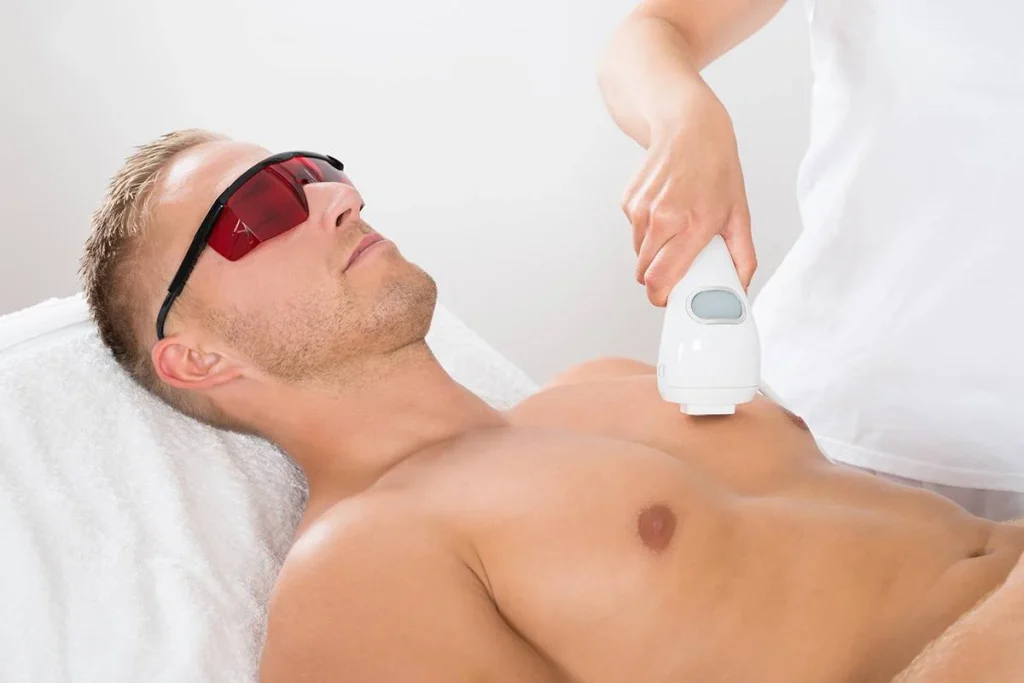 laser body hair remova